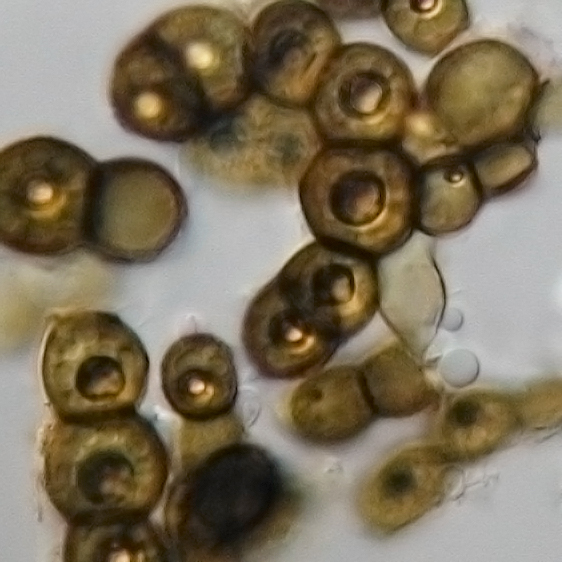 Exophiala phaeomuriformis