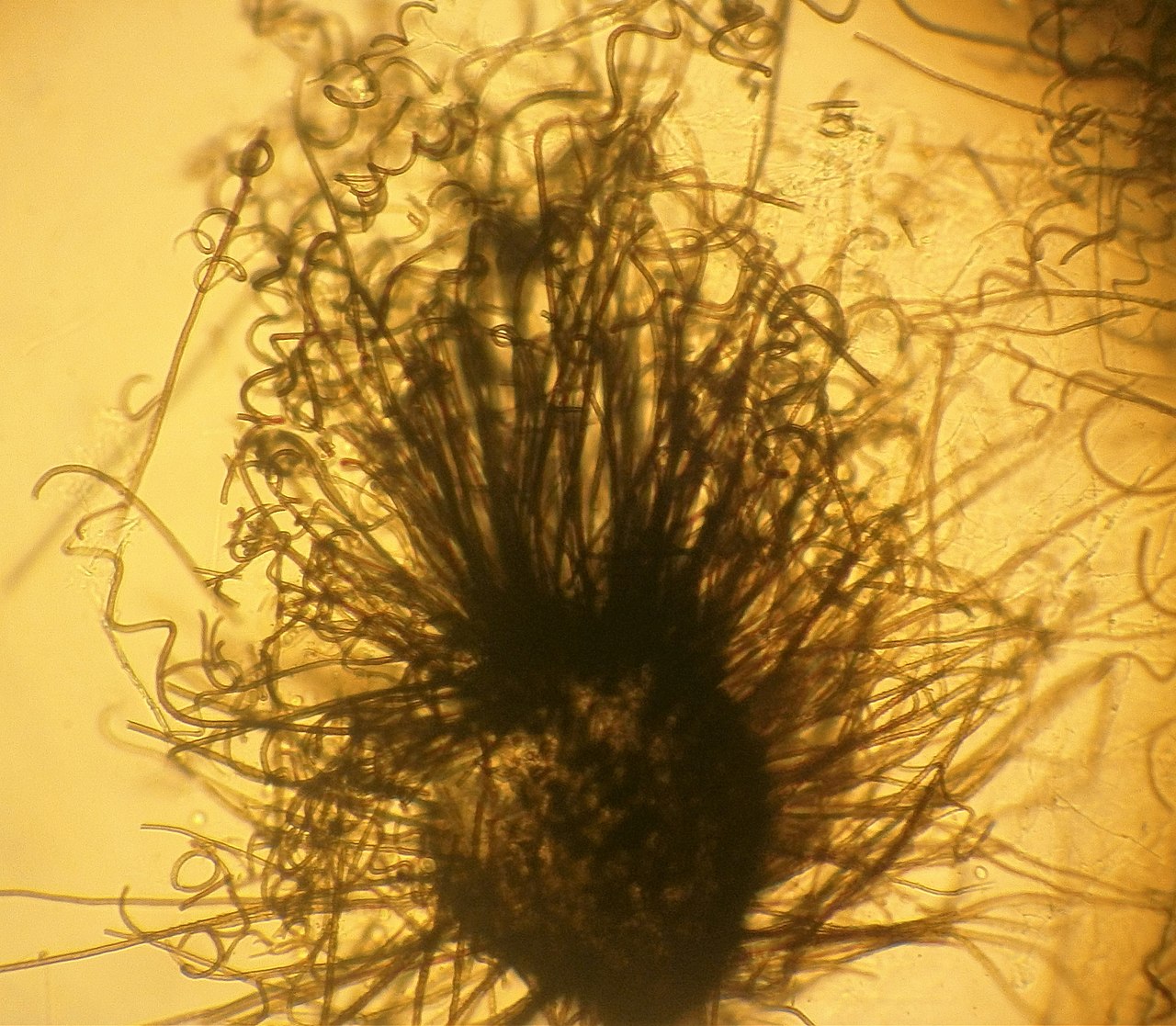 Chaetomium globosum