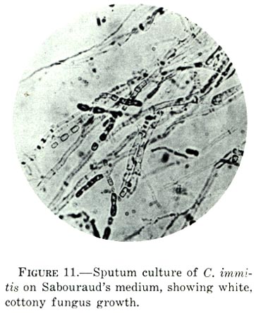 Coccidioides immitis