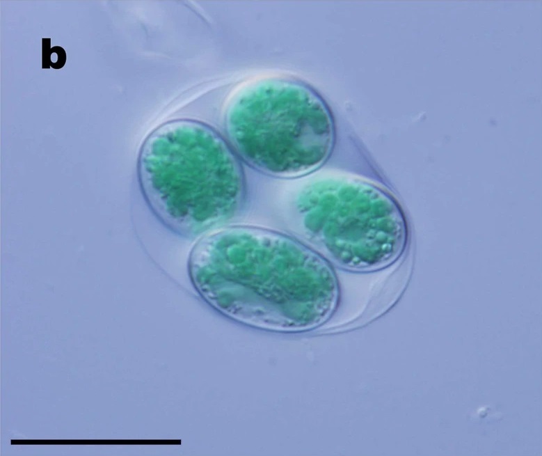 Glaucocystis nostochinearum