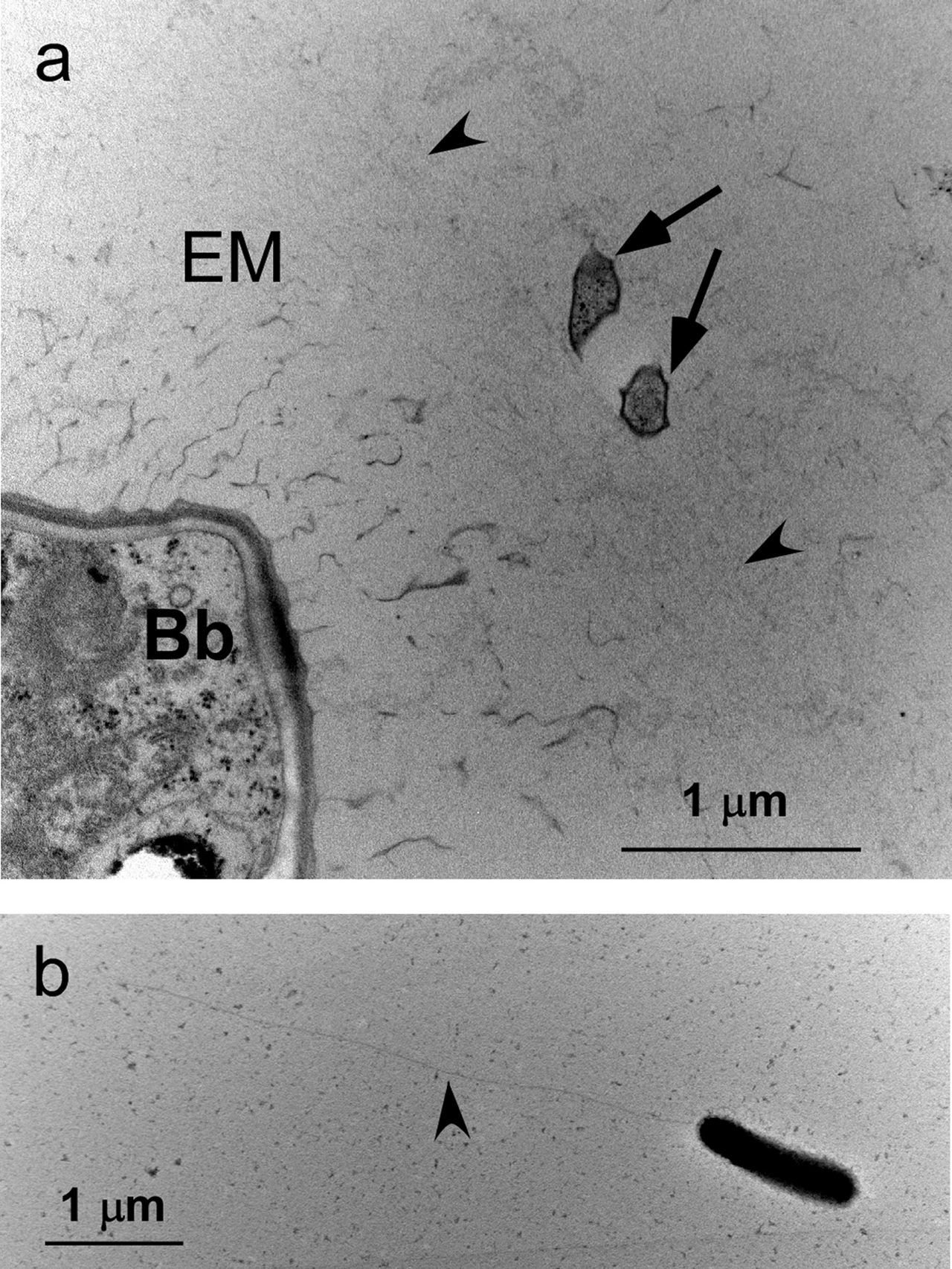 Botryococcus braunii