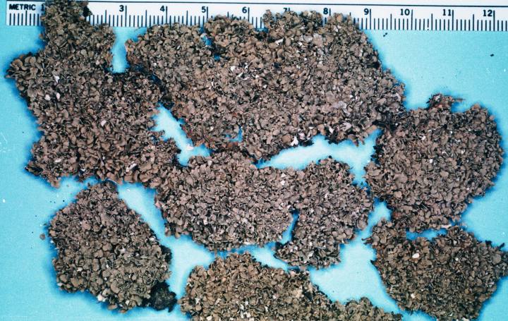 Stalkless cladoniais or the stalkless cu